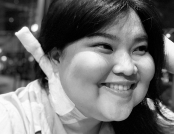 Cerita Shena Malsiana Idap Lupus dan Gagal Ginjal Kronis sampai Harus Cuci Darah