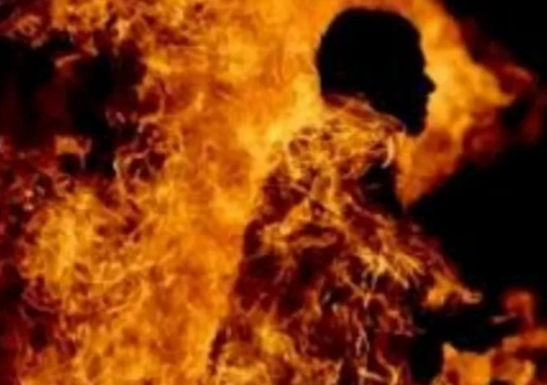 Sadis! Pria Ini Membakar Istrinya Hidup-Hidup, Luka Bakar hingga 90%