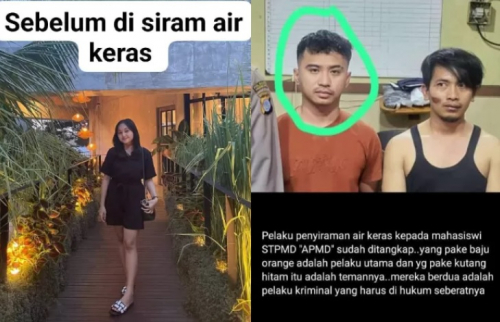 kronologi-mahasiswi-cantik-di-yogyakarta-disiram-air-keras-oleh-mantan-pacar